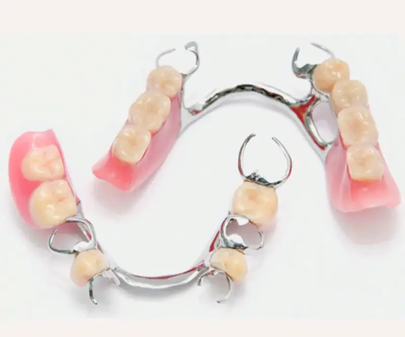 Prótesis Dentales Removibles Maipú - 4