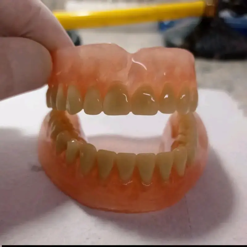 Prótesis Dentales Removibles Maipú - 5