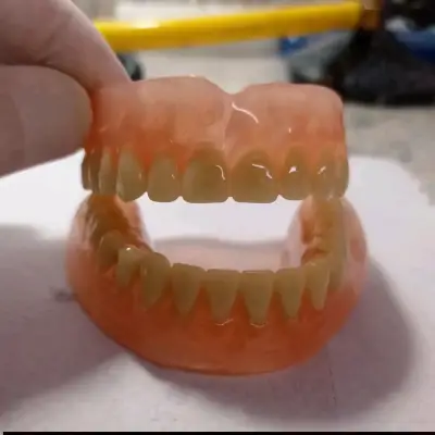 Prótesis Dentales Removibles Maipú - miniatura 5