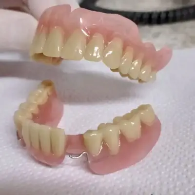 Prótesis Dentales Removibles Maipú - miniatura 6