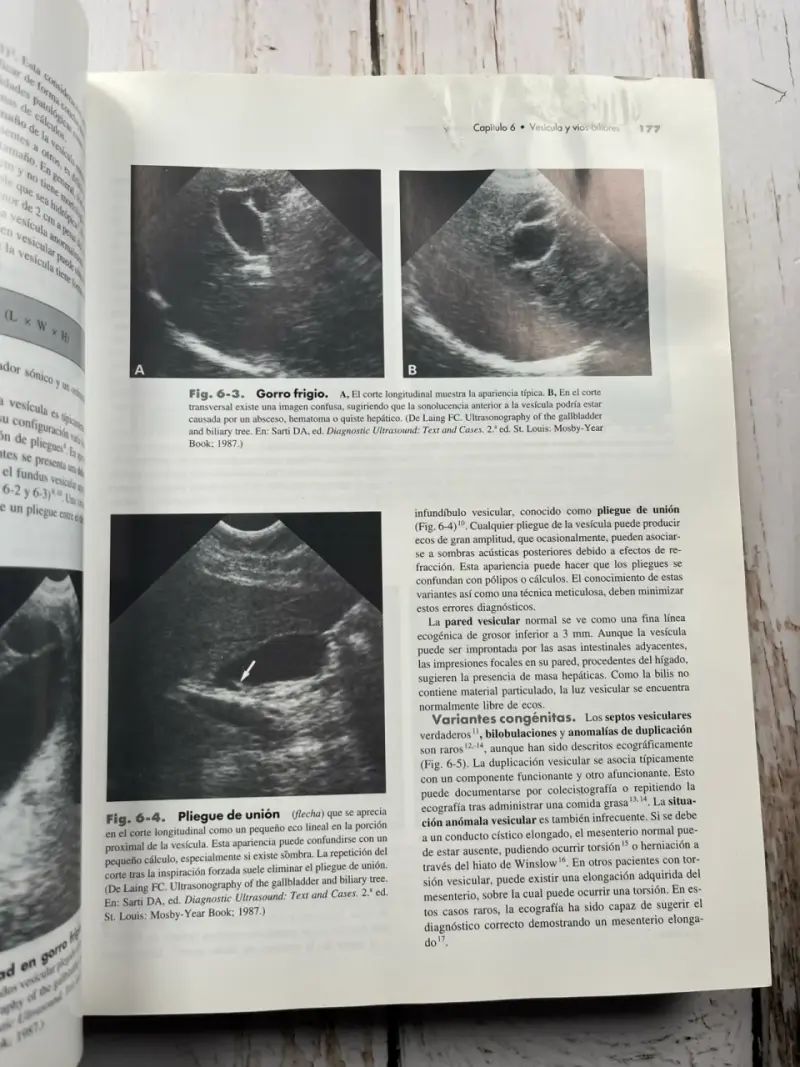 Diagnóstico por Ecografía (leer detalles) - 4