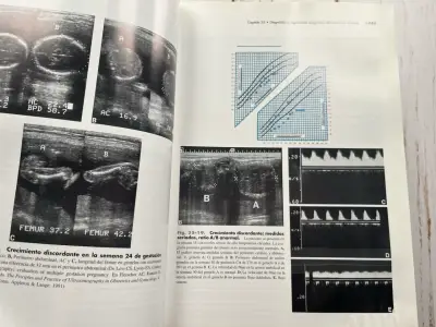 Diagnóstico por Ecografía (leer detalles) - miniatura 6