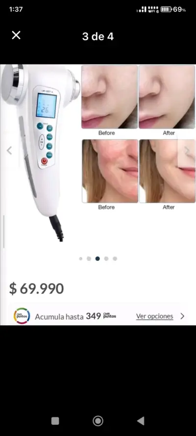 Dispositivo de Belleza 4 en 1 Ultrasónico - miniatura 4