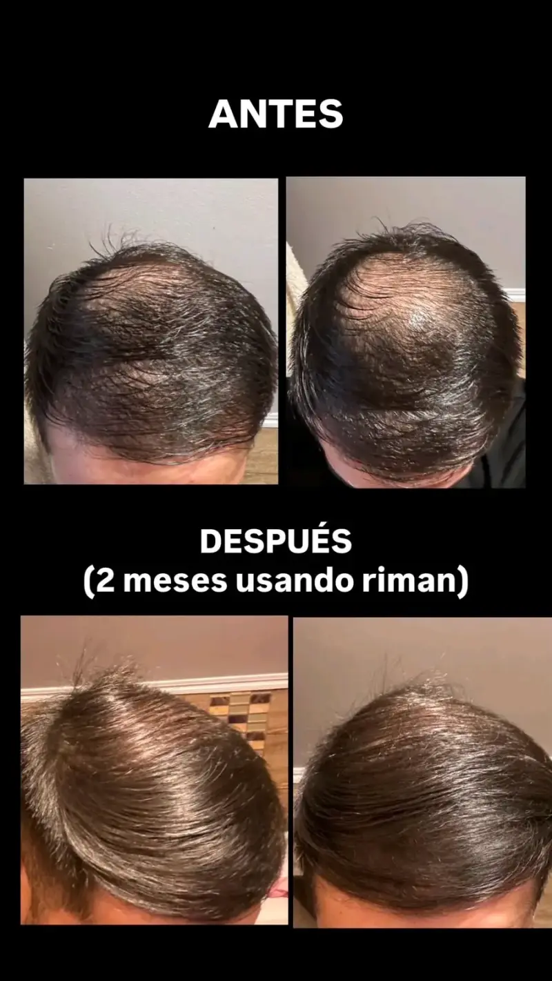 Set de Champú y Acondicionador Riman  Botalab