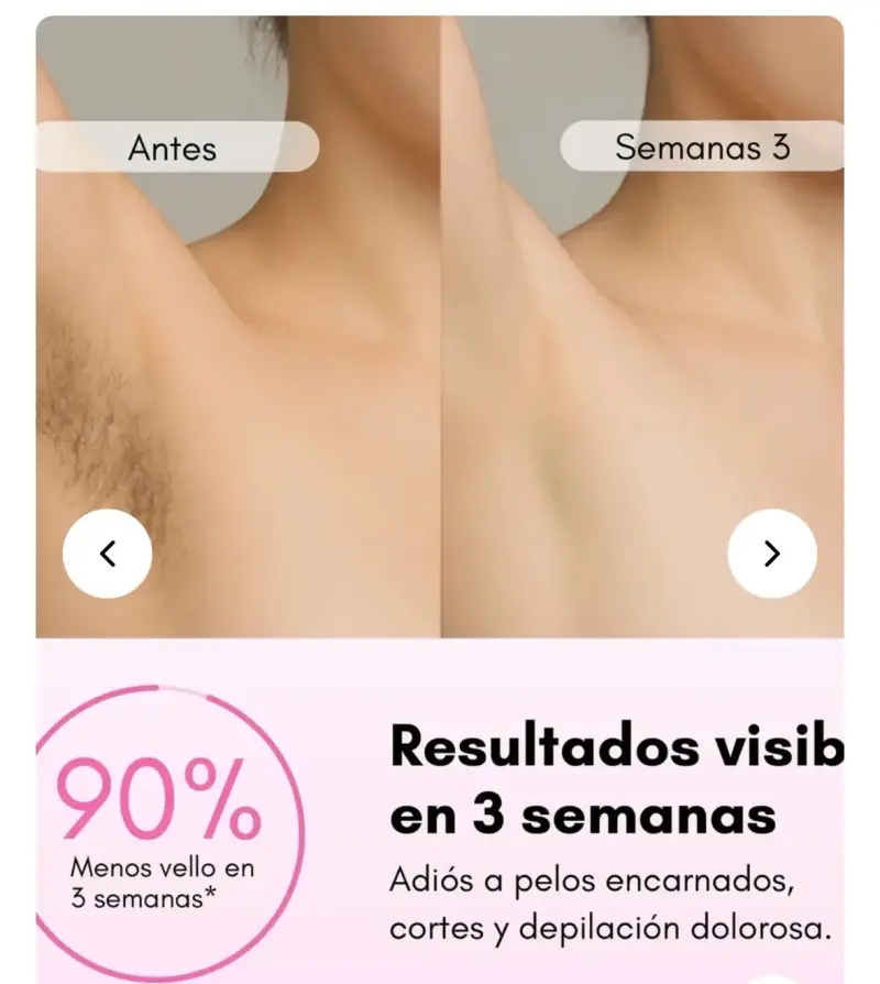 Depiladora láser Rebel Skin portátil con 5 niveles - 2
