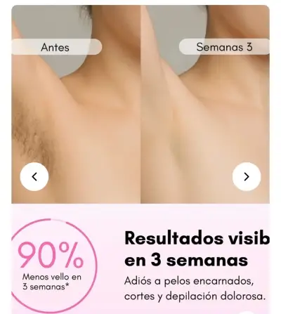 Depiladora láser Rebel Skin portátil con 5 niveles - miniatura 2