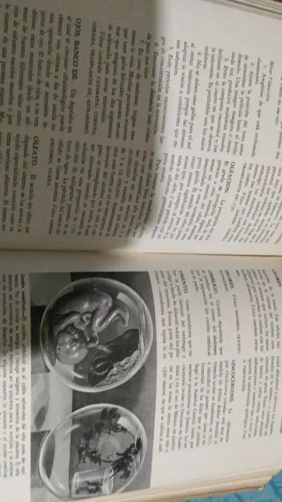 Enciclopedia Familiar de la Medicina y la Salud Volúmenes 1 y 2 - miniatura 4
