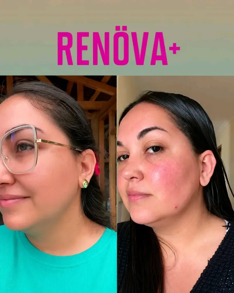 RENOVA 🩷 colágeno - 2