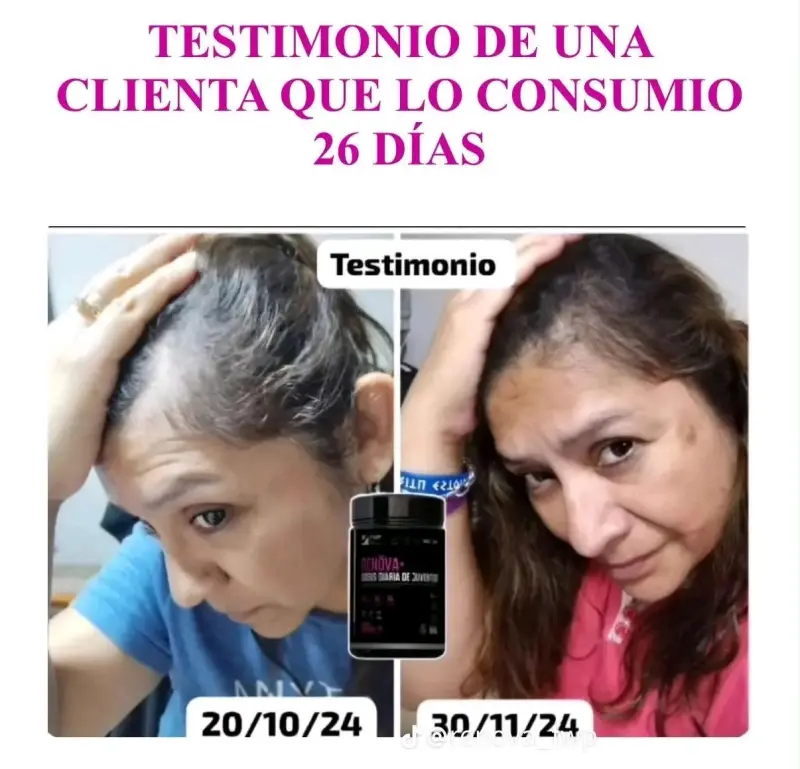 RENOVA 🩷 colágeno - 5