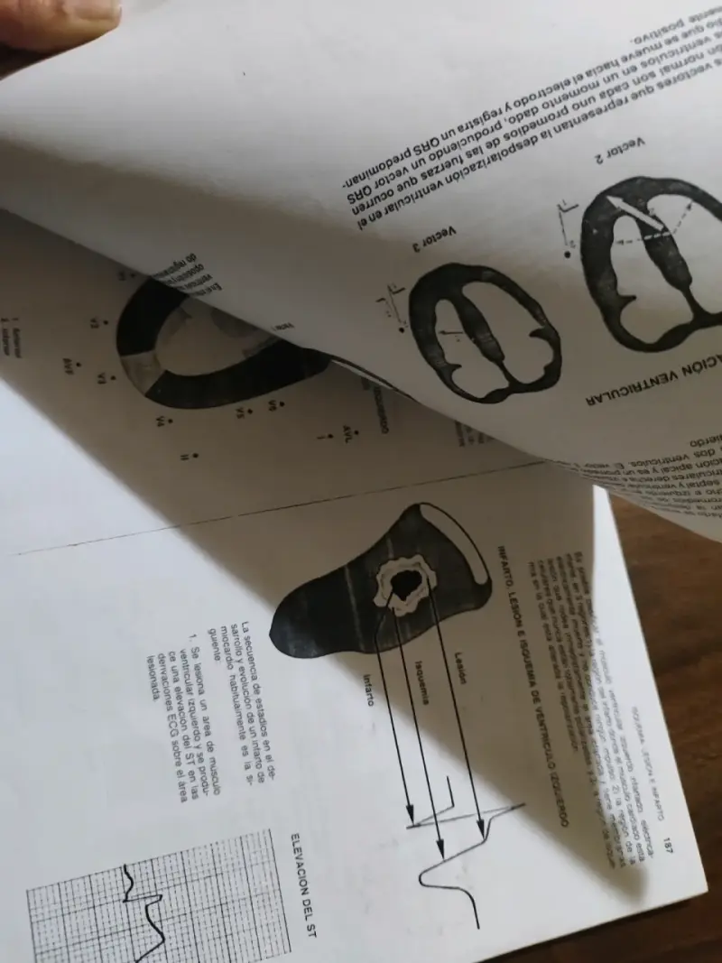 Impresión Libro Interpretación  ECG de Dale Davis - 2