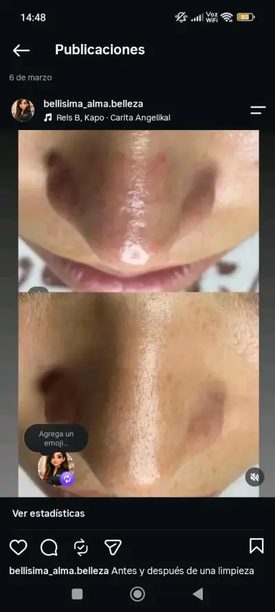 Servicios de estética integral y bienestar - miniatura 5