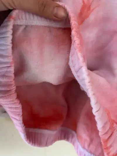 Polerón tie-dye rosa con logo Kappa - miniatura 6