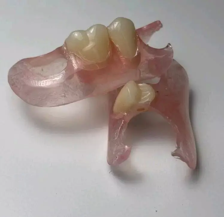 Prótesis dentales flexibles para adultos - 2