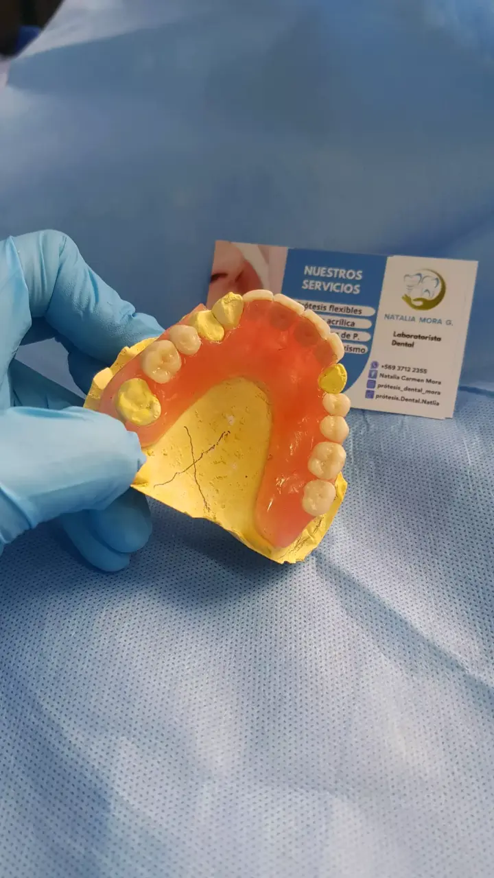 Prótesis dental removible para adultos - 2