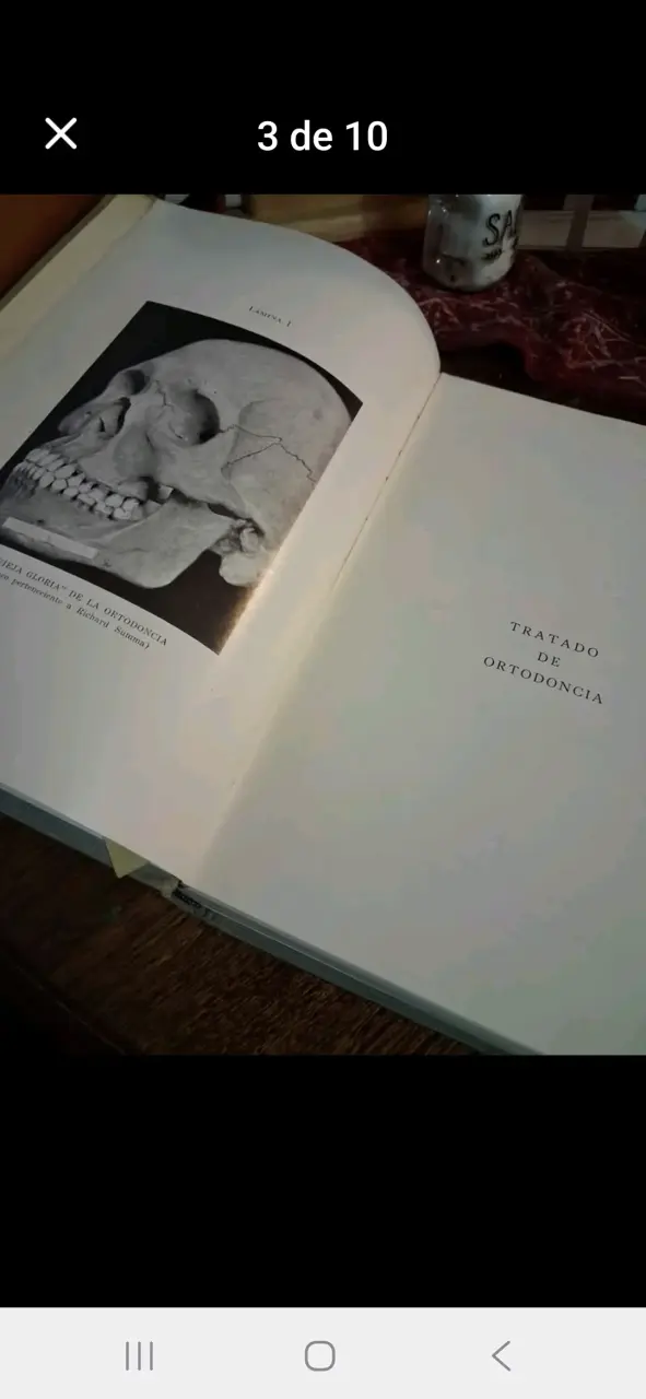 Libro Tratado de Ortodoncia de Robert H. W. Strang - 3