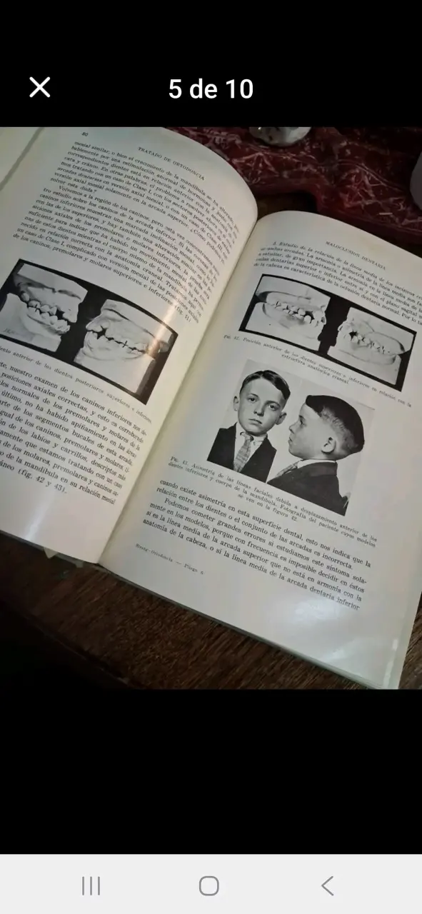 Libro Tratado de Ortodoncia de Robert H. W. Strang - 5