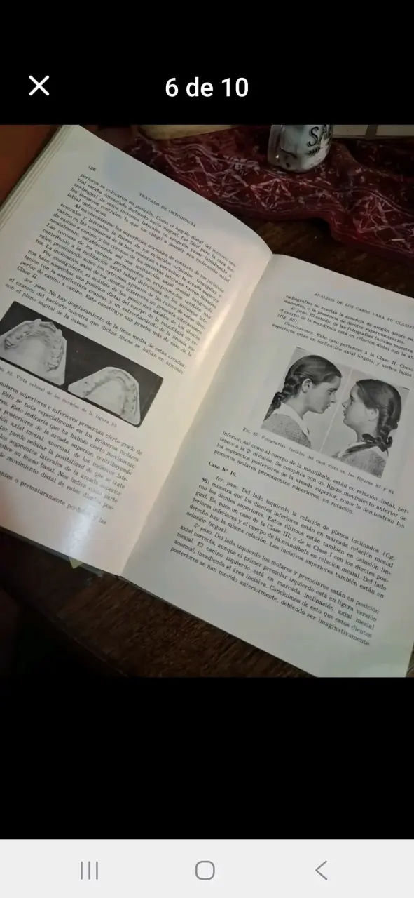 Libro Tratado de Ortodoncia de Robert H. W. Strang - 6