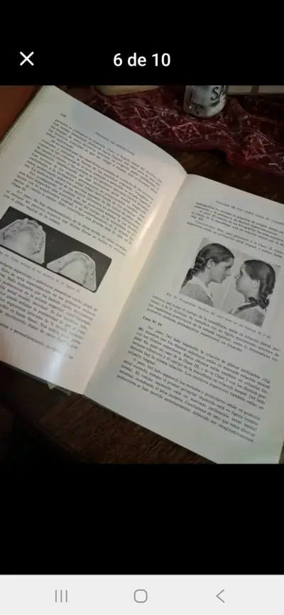 Libro Tratado de Ortodoncia de Robert H. W. Strang - miniatura 6