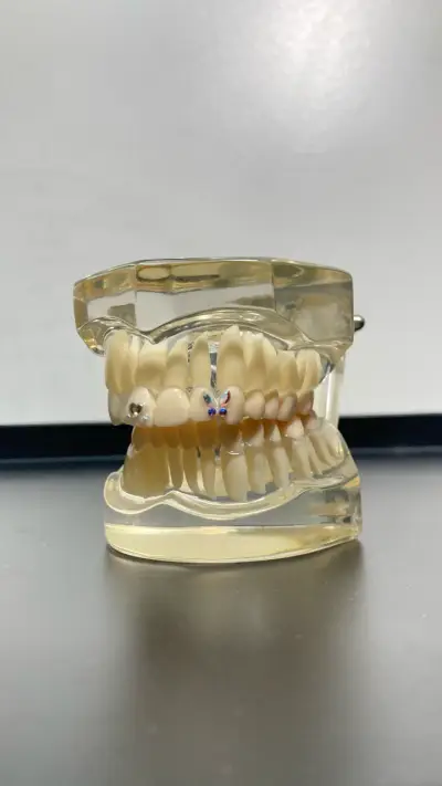 Articulador dental con aplicaciones de cristales - miniatura 1