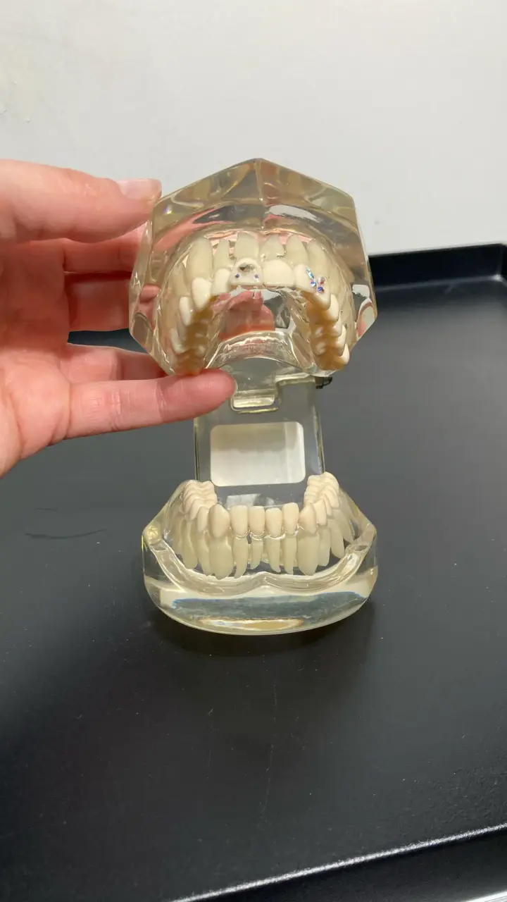 Articulador dental con aplicaciones de cristales - 2