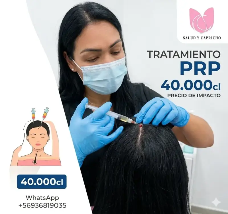 Tratamiento PRP para cabello saludable - 1
