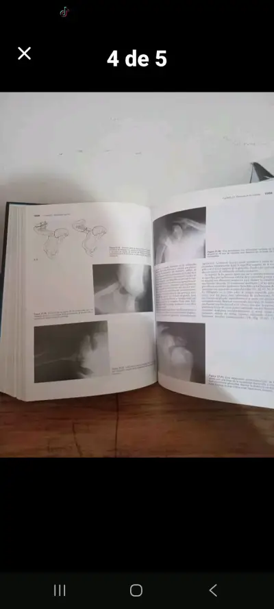 Libro Rockwood & Wilkins Fracturas en el Niño - miniatura 4