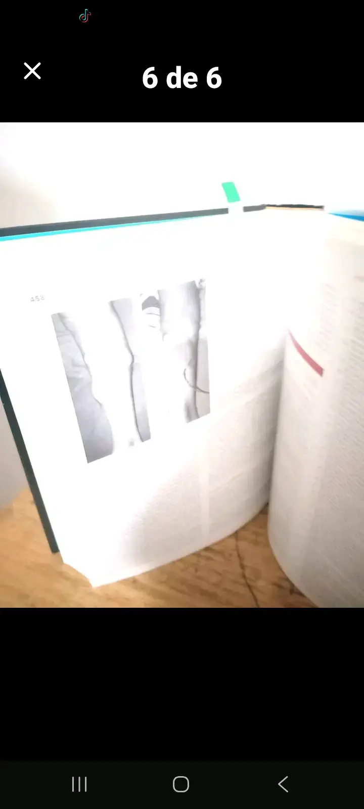 Libro Rockwood & Green's Fracturas en el Adulto - 6