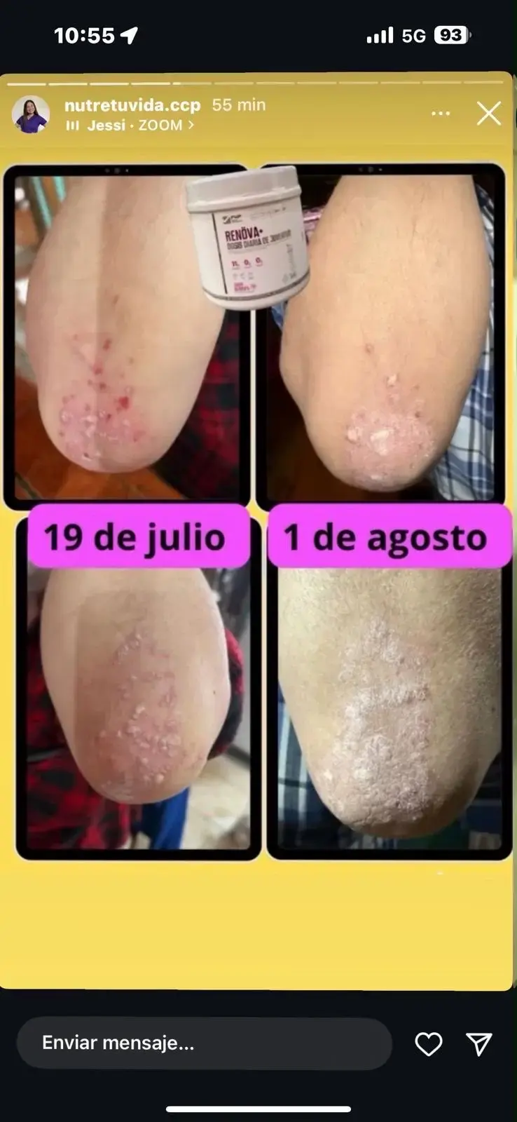 Suplemento en Polvo RVA+ Sabor Berries - 5