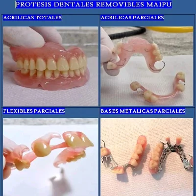 Prótesis D.